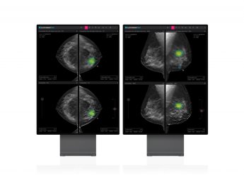 루닛, 3차원 유방암 검진 AI 솔루션 3월말 유럽 판매개시
