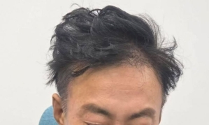 "1000만 탈모인 고민 대통령이 해결해주세요"…박명수 때아닌 호소