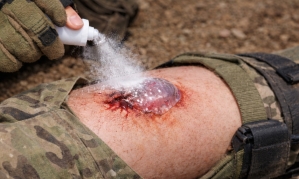 "피 철철 나는 부상자에 파우더 톡톡"… '1초면 지혈 끝' 한국서 개발