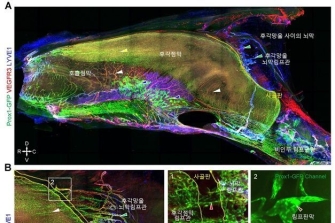 뇤 끂룓臾 諛곗텧援 李얠븯떎튂留 移섎즺 깉 湲[怨쇳븰쓣씫떎]