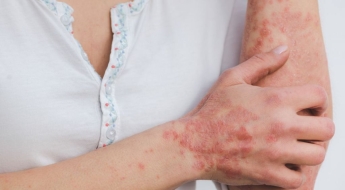 "살 빼려고 맞았는데 피부도 좋아졌다"…비만 치료제 의외 효과