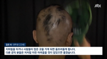 "온갖 일 다 하다…털 다 빠지고 호흡도 힘들어" 20대 공익의 눈물