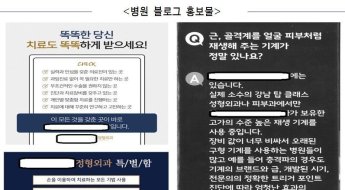 ‘진료일 쪼개기’…의사·환자 합심해 보험금 7억원 타냈다