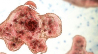 물놀이 비상…온천 다녀온 5세 여아, '뇌 먹는 아메바'에 혼수상태 