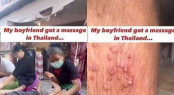 "동남아서 저렴한 마사지 신중해야"…의사 경고한 이유