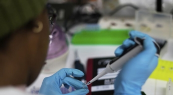'사별 뒤 20년간 나혼자 살아'…의학계도 놀란 80대 여성 HIV 감염