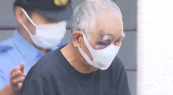 "그만 맞고 싶었다" 아들 살해 시도한 아버지…얼굴엔 선명한 피멍 자국이