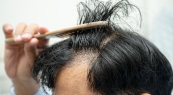 춥다고 '이것' 돌려 쓰다간 머리카락 우수수…전문가 경고