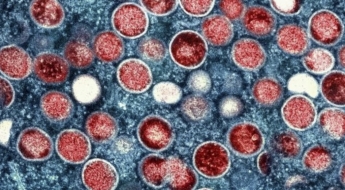 "걸리면 고열·발진" 사망자 201명인데…아시아에서 '새 변이' 발견