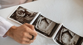 정자 기증해 197명 아이 낳은 남성…