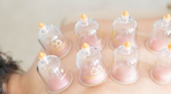 주사 이모? '침 삼촌'도 있었다…무면허로 한방 시술 중국인 징역형