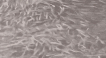 '대지진 전조 아니냐' 수면 뒤덮은 물고기 떼에…오사카 '술렁'