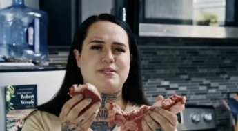 매일 생고기 900g 먹던 美 여성…건강 검진 결과 '충격'