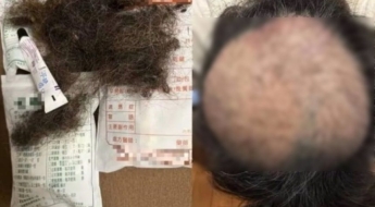 "식당 악취에 머리 빠졌다"…탈모 사진 공개에 논란 확산, 악취 기준치의 '10배'