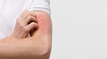 "치료 어려운데, 벌써 14명 확진"…성관계 후 '희귀 곰팡이' 집단감염 우려에 美 비상