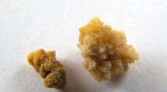 '희귀 보석'인 줄 알고…도둑들이 훔쳐 간 '보관품'의 정체