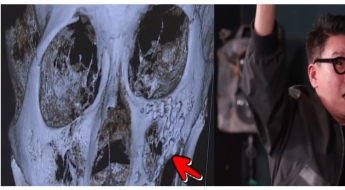 "얼굴에 철심 가득" "전치 8주"…이상민, 과거 폭행사건에 입 열었다