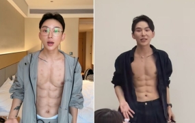 '8억 인공 복근' 자랑한 인플루언서…"건강에 치명적" 전문가 경고