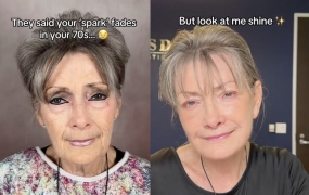 "30년을 되돌렸다"…안면거상술로 변신한 70대 여성 '화제'