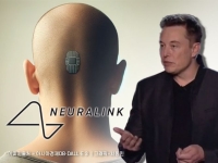 '뇌에 칩 이식' 韓 유튜버, 머스크 임상 실험 참가…