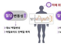 혈당·혈압 변화 클수록 '치매' 위험 높아진다