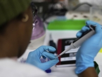 '사별 뒤 20년간 나혼자 살아'…의학계도 놀란 80대 여성 HIV 감염
