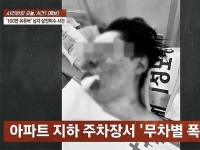 납치·폭행 당한 유튜버가 전한 말… 