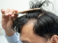 춥다고 '이것' 돌려 쓰다간 머리카락 우수수…전문가 경고