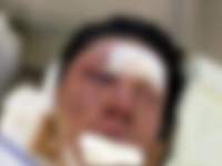 "손 묶고 가슴을 수차례…" 납치 상황 전말 공개한 유튜버