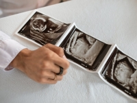 정자 기증해 197명 아이 낳은 남성…