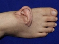 발등에서 귀가 왜 나오는데?…5개월 만에 되돌린 의학의 기적