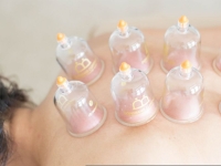 주사 이모? '침 삼촌'도 있었다…무면허로 한방 시술 중국인 징역형