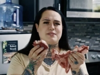 매일 생고기 900g 먹던 美 여성…건강 검진 결과 '충격'