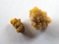 '희귀 보석'인 줄 알고…도둑들이 훔쳐 간 '보관품'의 정체