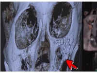 "얼굴에 철심 가득" "전치 8주"…이상민, 과거 폭행사건에 입 열었다