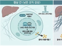 간이 딱딱해지면 왜 병이 악화될까…서울대 연구팀 해답 찾았다[과학을읽다]