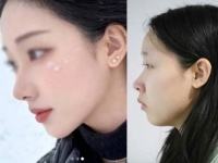 "어? 김소영, 걔 아니야?"…신상공개 되자 증언 쏟아졌다