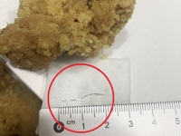 치킨 먹다 구토, 목에 2㎝ 철사 박혔는데…치킨회사 책임 없다고?[최석진의 로앤비즈]