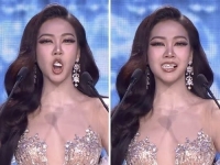 미인대회 참가자 입에서 '툭' 떨어진 치아…침착한 대처에 '박수'