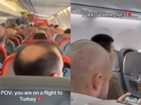 튀르키예行 비행기에는 대머리 손님 뿐…이유 뭐길래
