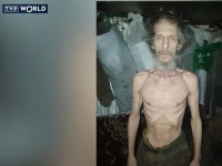 "식량 없이 빗물로 17일 버텨"…우크라 병사들 영양실조 '발칵'