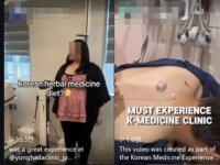 침 치료에 부항까지…외국인 관광객 사로잡은 K한의원