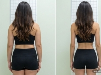 "살이 정말 무섭게 빠지더라" 한달만에 6㎏ 뺀 20대가 마운자로 끊은 이유