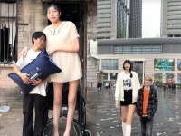 키 220㎝ 26세 여성 출산 후 1년 만에 …'거인증' 뒤 숨겨진 치명적 합병증