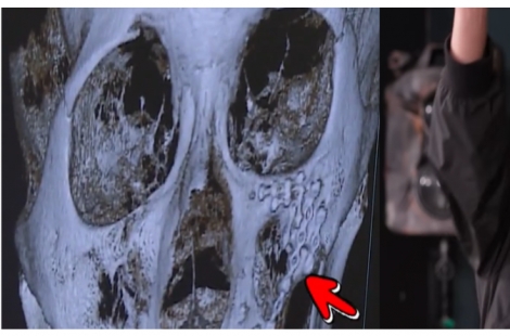 "얼굴에 철심 가득" "전치 8주"…이상민, 과거 폭행사건에 입 열었다