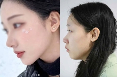 "어? 김소영, 걔 아니야?"…신상공개 되자 증언 쏟아졌다