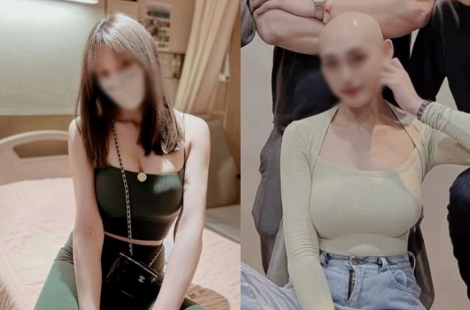 겨우 29살인데…악성 림프종과 싸우던 인플루언서, 끝내 사망