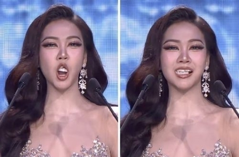 혹시 틀니? 미인대회 참가자 입에서 치아가 '툭'…침착한 대처에 '박수'