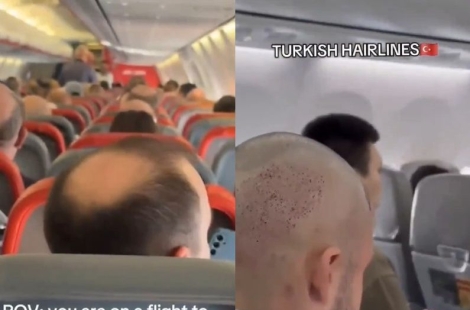 튀르키예行 비행기에는 대머리 손님 뿐…이유 뭐길래