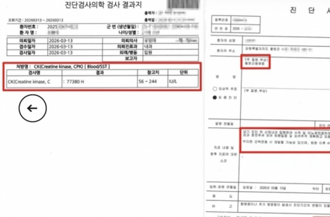 "너무 힘듭니다" 애원에도 '강제 팔굽혀펴기'…근육 녹아내린 병사